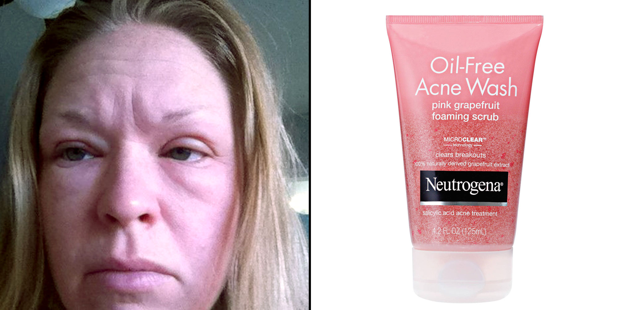 Is Neutrogena Face Wash Bad For Your Skin at Charles Lyons blog