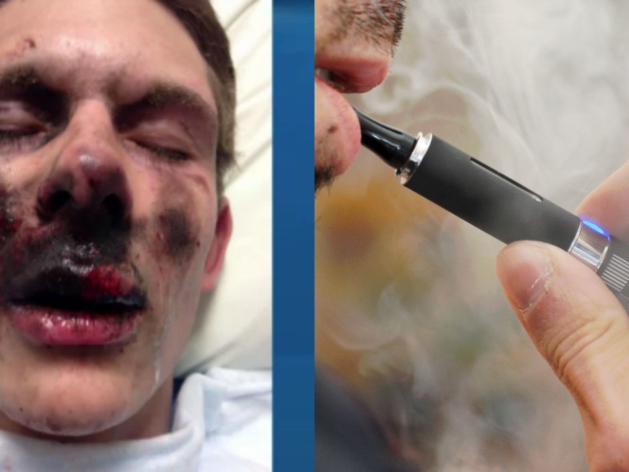 can vapes explode Dropped Vape in Water: Will it Explode?